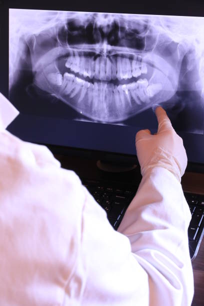 Best Emergency Care for Gum Disease in Mundelein, IL